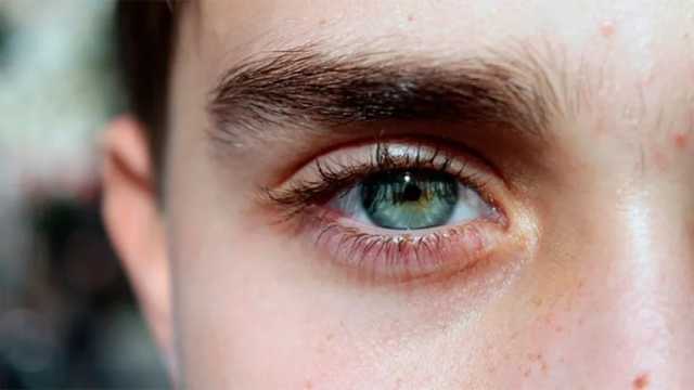 El ojo seco es una de las primeras causas de absentismo laboral. (Foto: Pixabay)