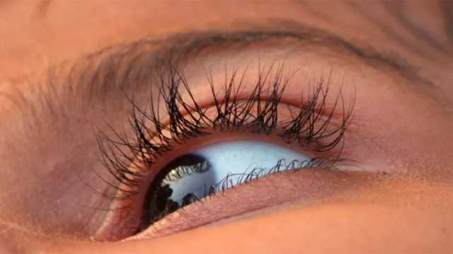 Una de las causas del ojo seco es la inflamación del párpado. (Foto: Pixabay)