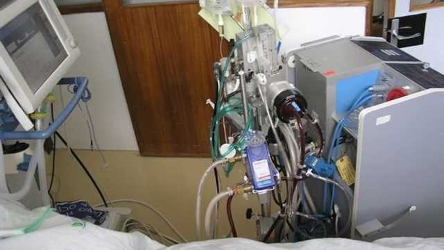 Máquina de circulación extracorpórea también conocida como máquina de derivación cardiopulmonar. (Foto: Wikimedia)