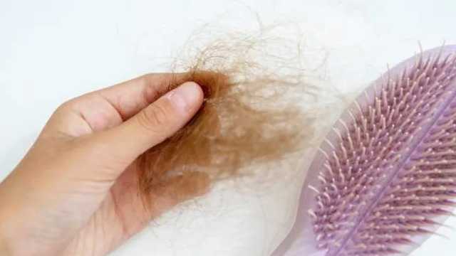 La alopecia areata es una afección que causa una pérdida temporal o permanente de pelo. (Foto: Envato)